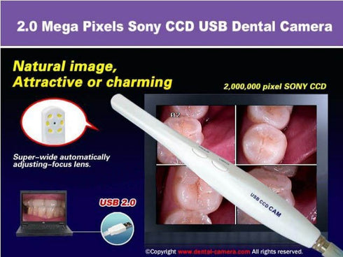 Hao Health USB Dental Intraoral Cameras HK760